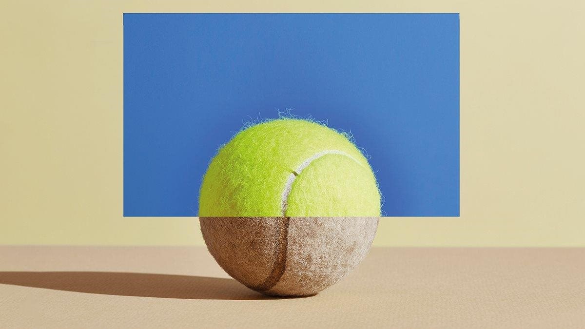 Waxing and waning AMD and cortical atrophy College of Optometrists